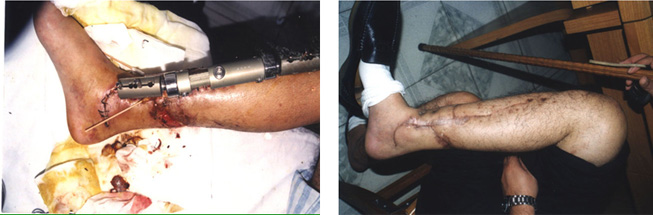 CC网投·(中国游)官方网站