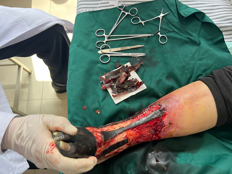 CC网投·(中国游)官方网站