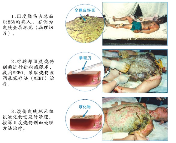 CC网投·(中国游)官方网站