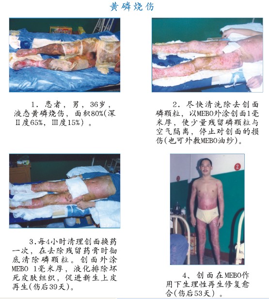 CC网投·(中国游)官方网站